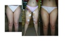 before, week after,2months after